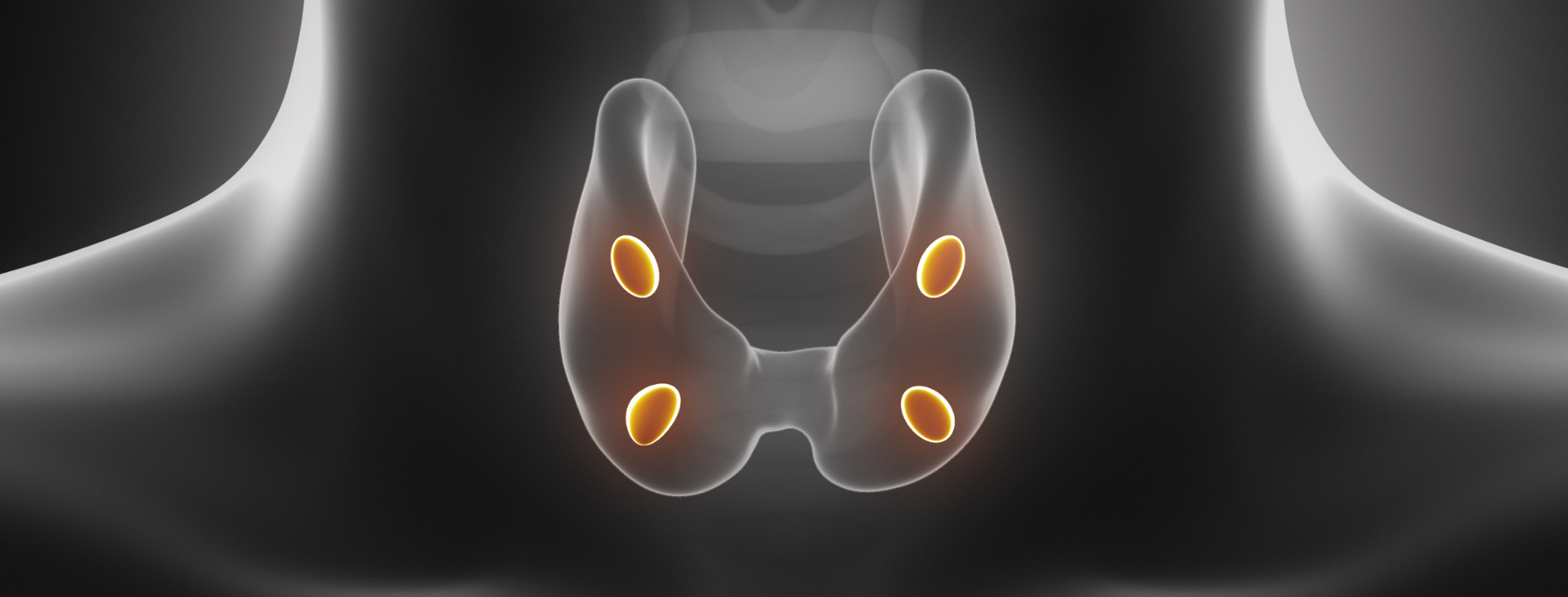 X-ray illustration of parathyroids.